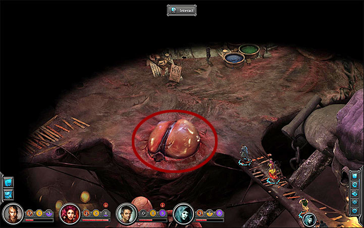 The Cyst is near the store of Sundermun the Elder - Where to obtain the scalpel for opening Maws in Bloom? - Puzzles and additional activities - Torment: Tides of Numenera Game Guide